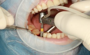 proteze dentare in sectorul 2
